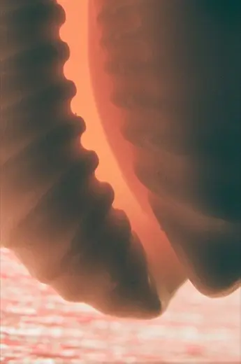 MOAR study image 003